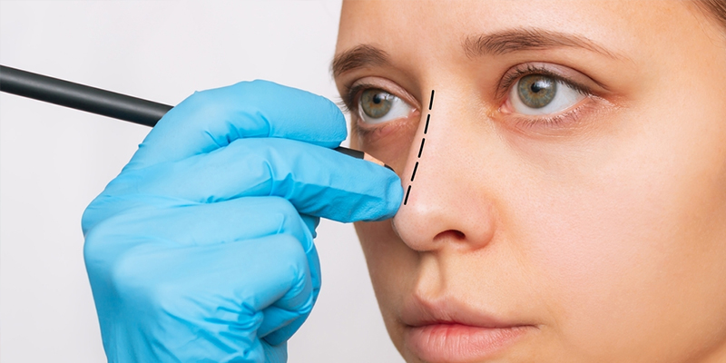 Is Rhinoplasty Covered by Insurance in India?