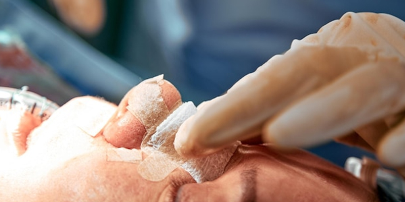 Why Rhinoplasty Get Infected?