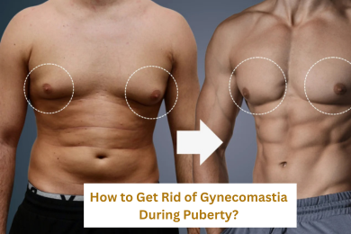 How to Get Rid of Gynecomastia During Puberty?