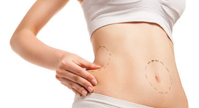 laser lipo in Delhi