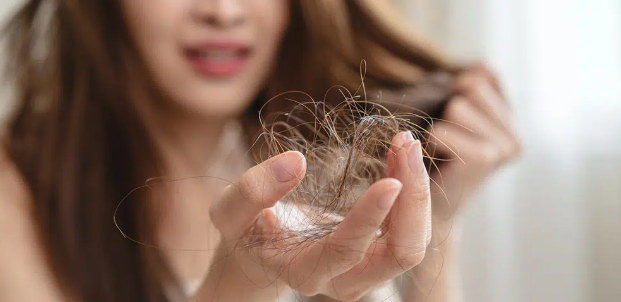 hair loss treatment in Delhi