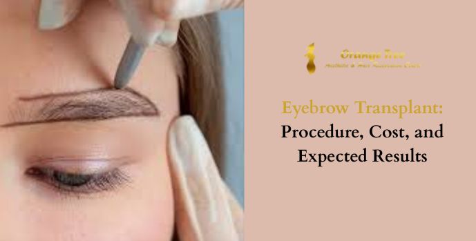 Eyebrow Transplant: Procedure, Cost, and Expected Results