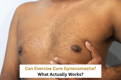 Can Exercise Cure Gynecomastia? What Actually Works?