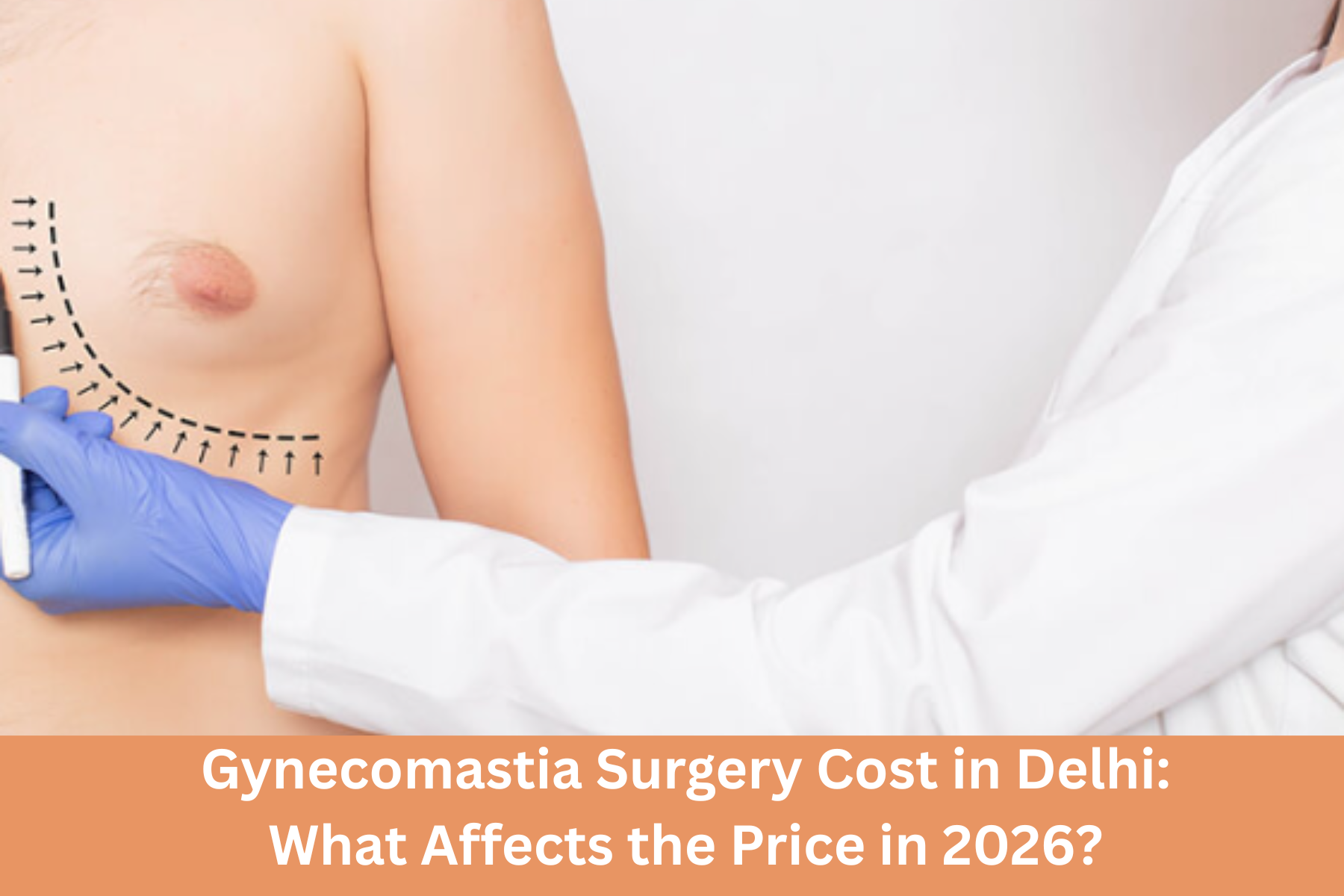 gynecomastia surgery cost in Delhi