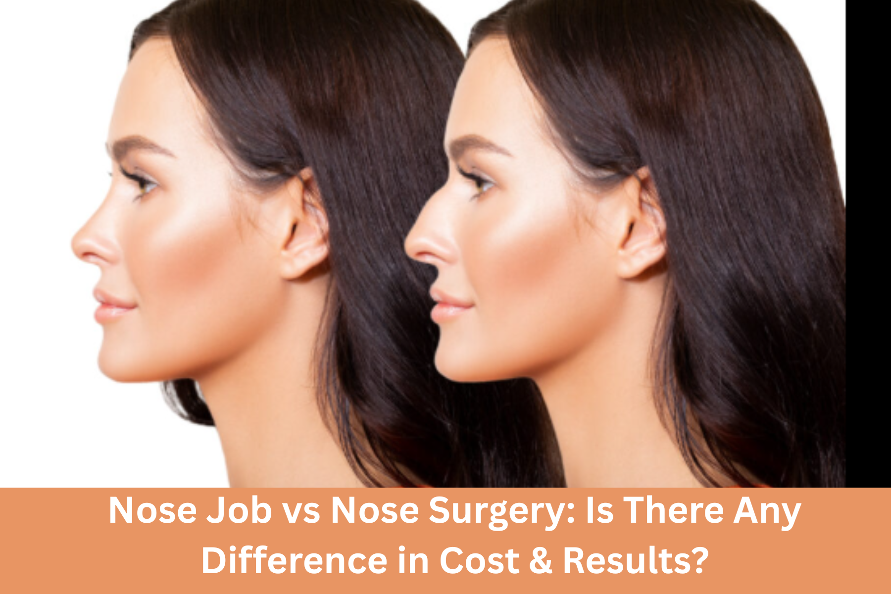 Nose Job vs. Nose Surgery: Is There Any Difference in Cost & Results?