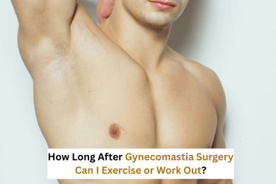 Gynecomastia treatment in Delhi
