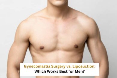 Gynecomastia treatment in Delhi