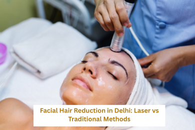 facial laser hair removal in Delhi