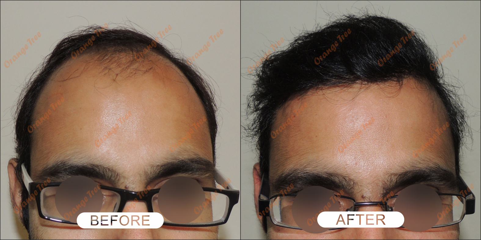 Best Cosmetic Plastic Surgery & Hair Care Clinic in Delhi, Kolkata & Manipur